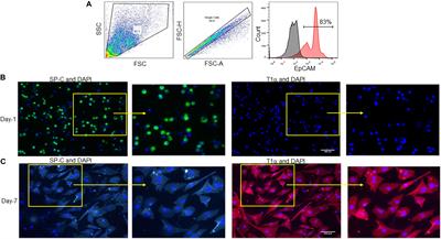 Extracellular CIRP Induces Inflammation in Alveolar Type II Cells via TREM-1